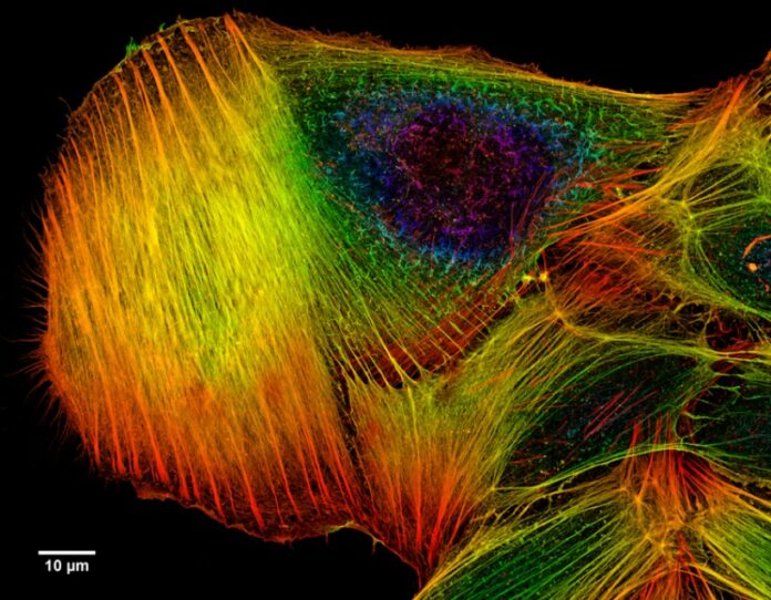 Depth_Coded_Phalloidin_Stained_Actin_Filaments_Cancer_Cell.jpg