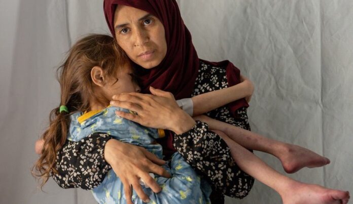UN Gaza famine | Gaza